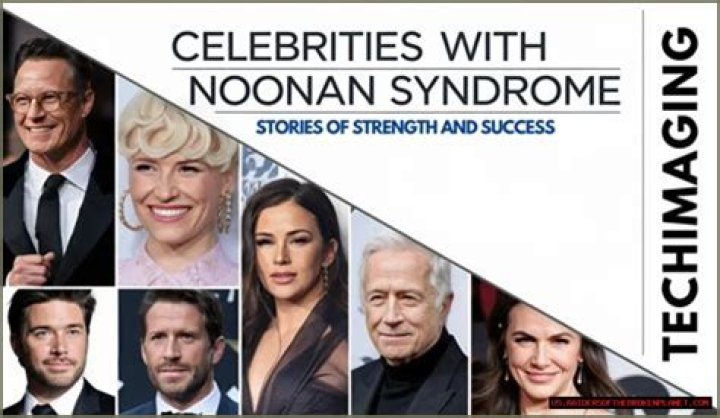 Inspiring Lives: Famous People With Noonan Syndrome