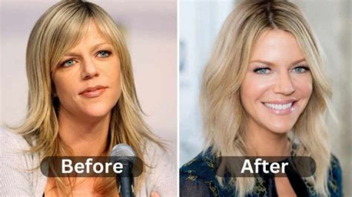 Unveiling Laura Ingraham: A Look At Her Journey Before Plastic Surgery